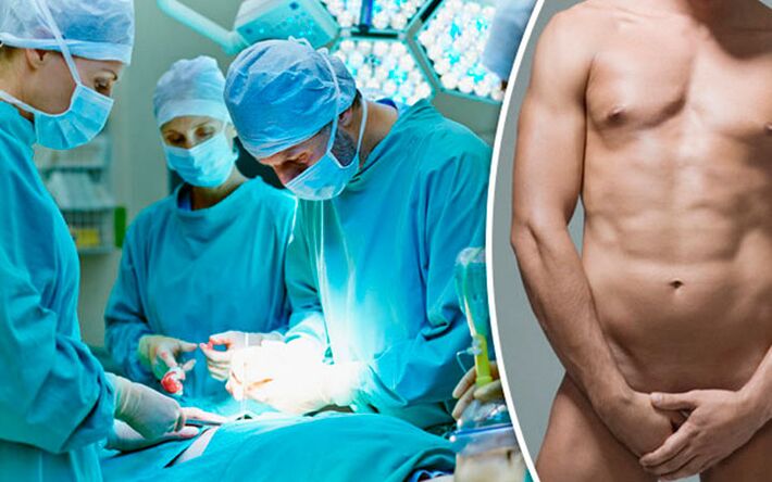 Surgical enlargement of the penis